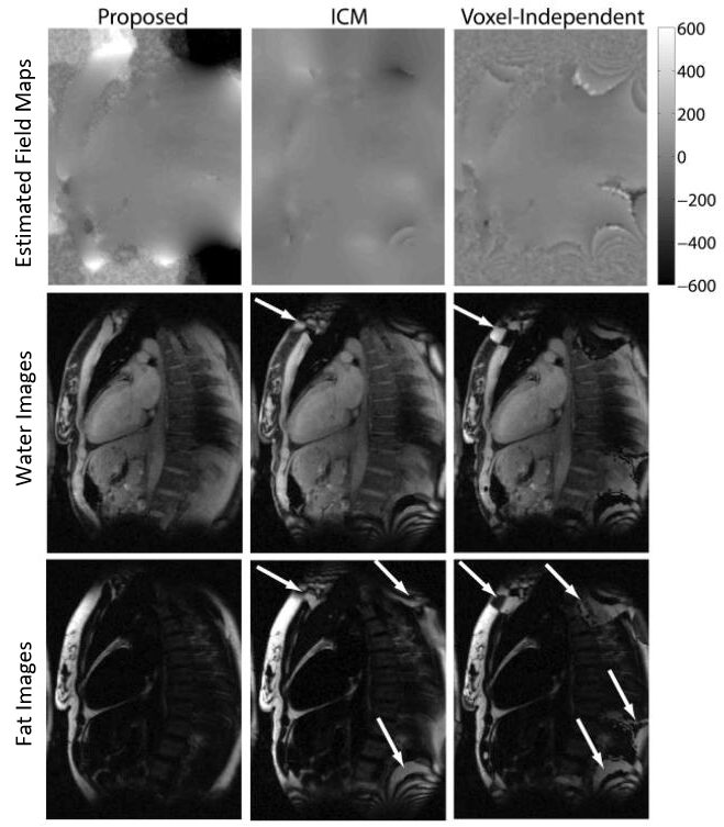Comparison of a proposed method with two previously proposed methods for fat quantification