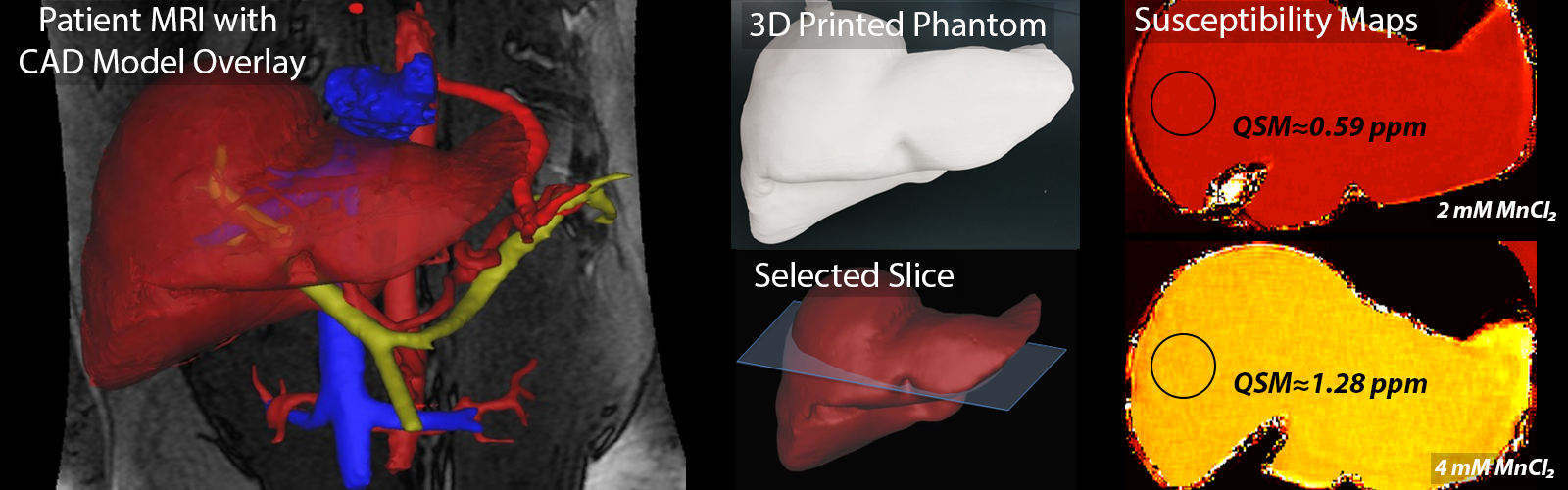 Selected example MRI images and renderings