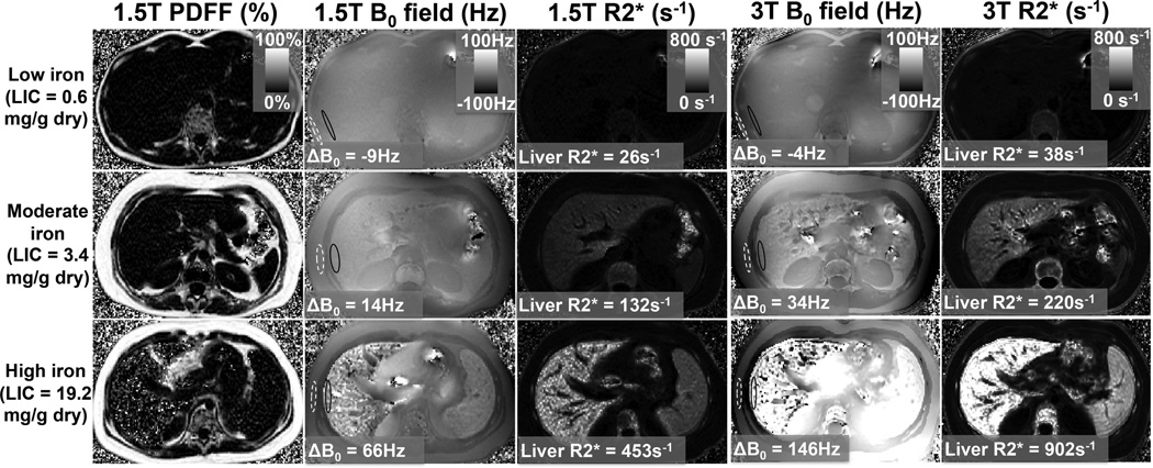 Example quantitative PDFF and R2* maps in the liver.
