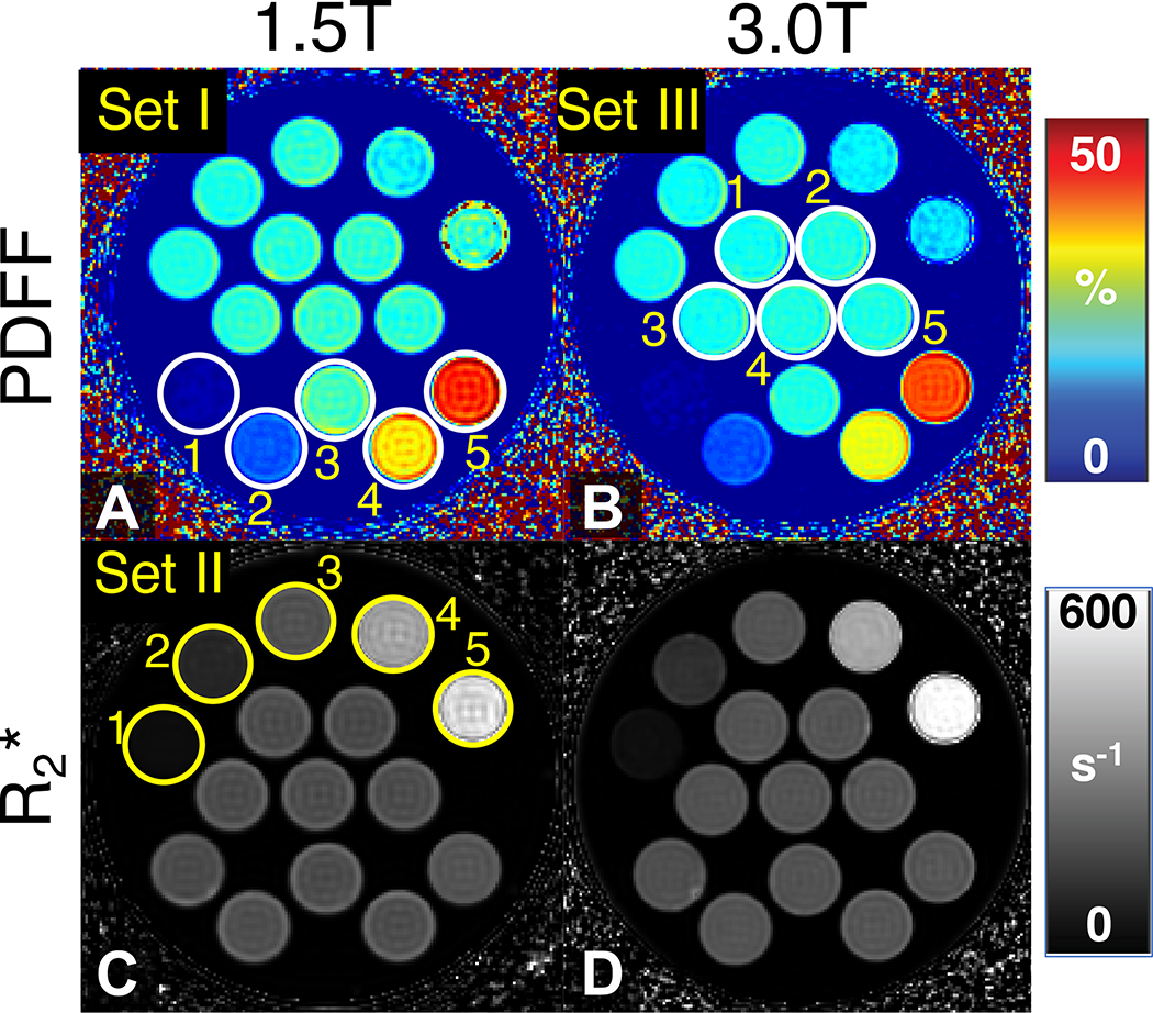 Representative PDFF map and R2* map of PDFF‐R2*‐T1 phantoms at both 1.5 T and 3 T.