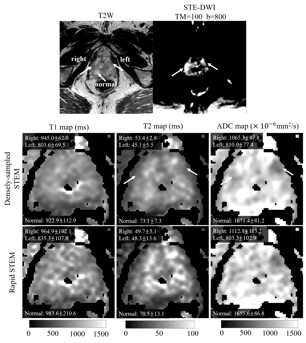 Diffusion MRI in the Body – Quantitative Imaging Methods Lab – UW–Madison